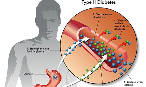 LE INFEZIONI E IL DIABETE